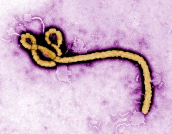 性生活是埃博拉的传播途径吗？